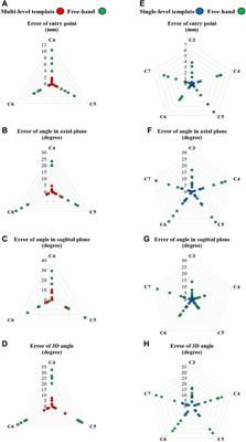 Design, fabrication, and evaluation of single- and multi-level 3D-printed non-covering cervical spinal fusion surgery templates